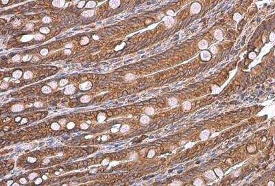 Immunohistochemistry-Paraffin: GRP78/HSPA5 Antibody [NBP2-16749]
