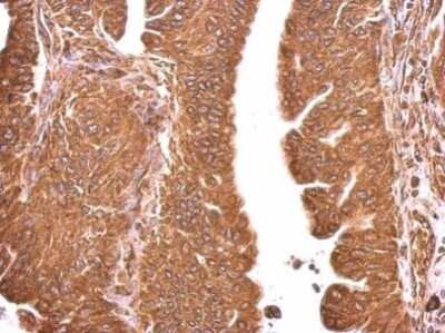 Immunohistochemistry-Paraffin: GRP78/HSPA5 Antibody [NBP2-42848]
