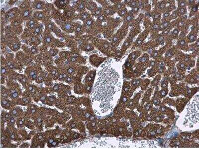 Immunohistochemistry-Paraffin: GRP78/HSPA5 Antibody [NBP2-42848]