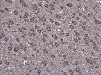 Immunohistochemistry-Paraffin: GRP78/HSPA5 Antibody [NBP2-42848]