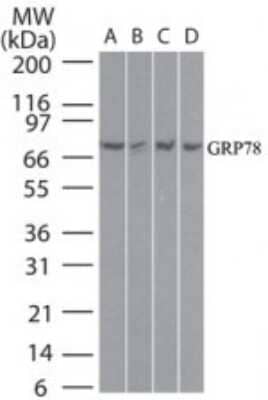 Western Blot: GRP78/HSPA5 Antibody [NB100-56411]