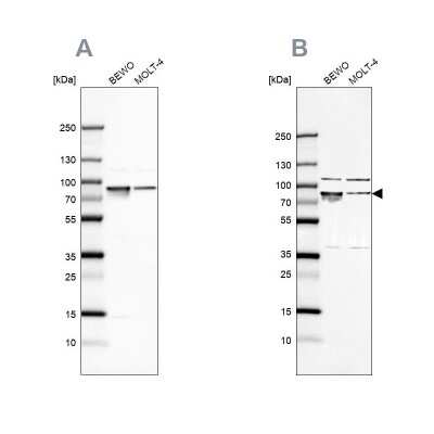 Western Blot: GRP78/HSPA5 Antibody [NBP1-89968]