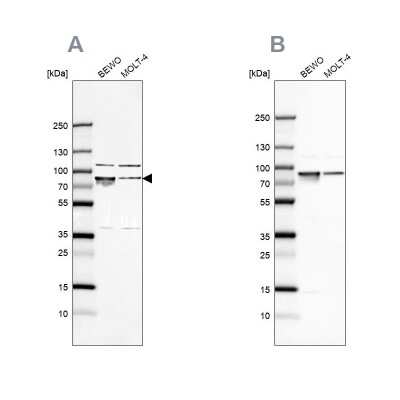 Western Blot: GRP78/HSPA5 Antibody [NBP1-89969]