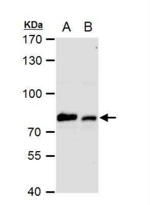 Western Blot: GRP78/HSPA5 Antibody [NBP2-16749]