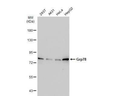 Western Blot: GRP78/HSPA5 Antibody [NBP2-16749]