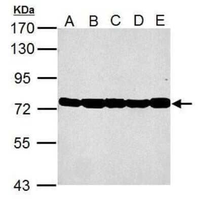 Western Blot: GRP78/HSPA5 Antibody [NBP2-42848]