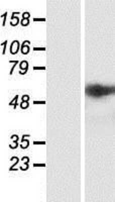 Western Blot: GRP78/HSPA5 Overexpression Lysate [NBP2-10471]