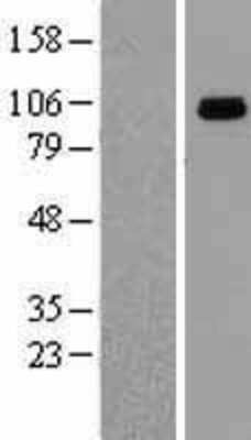 Western Blot: gp96/HSP90B1/GRP94 Overexpression Lysate [NBL1-11746]