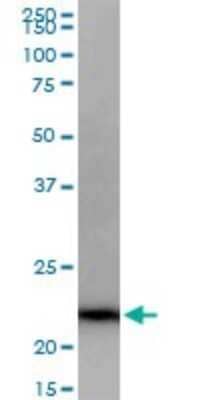 Western Blot: GRPEL1 Antibody [H00080273-B01P]