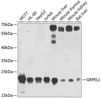 Western Blot: GRPEL1 AntibodyBSA Free [NBP3-04531]