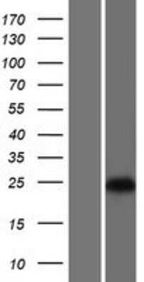 Western Blot: GRPEL1 Overexpression Lysate [NBP2-06228]