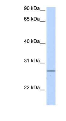 Western Blot: GRPEL2 Antibody [NBP1-54666]