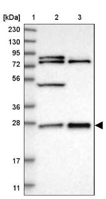 Western Blot: GRPEL2 Antibody [NBP1-85099]