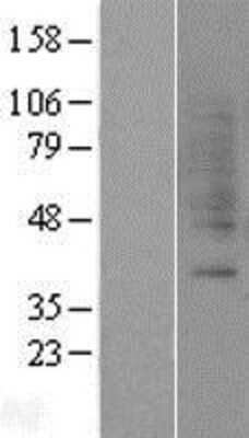 Western Blot: Gastrin-releasing Peptide R/GRPR Overexpression Lysate [NBP2-04290]