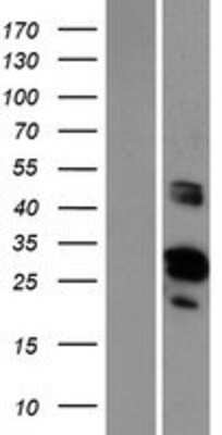 Western Blot: GRRP1 Overexpression Lysate [NBP2-06277]