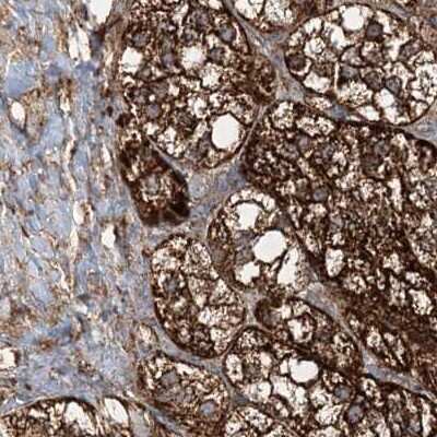 Immunohistochemistry-Paraffin: GRSF1 Antibody [NBP1-89488]