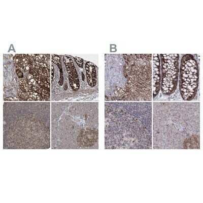 Immunohistochemistry-Paraffin: GRSF1 Antibody [NBP1-89488]