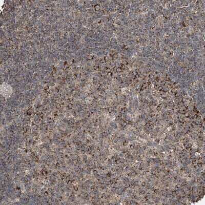 Immunohistochemistry-Paraffin: GRSF1 Antibody [NBP1-89488]