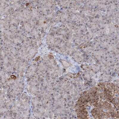 Immunohistochemistry-Paraffin: GRSF1 Antibody [NBP2-38341]