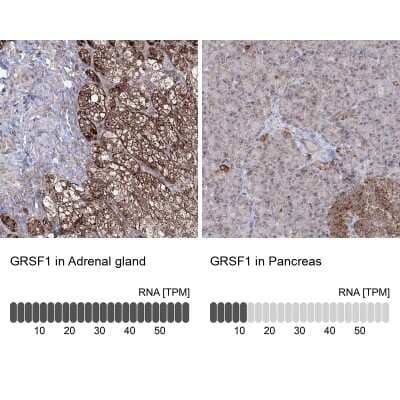 Immunohistochemistry-Paraffin: GRSF1 Antibody [NBP2-38341]