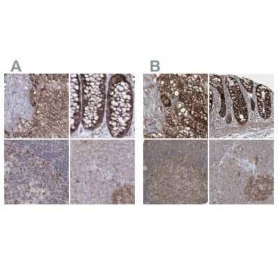 Immunohistochemistry-Paraffin: GRSF1 Antibody [NBP2-38341]