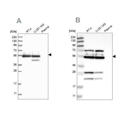 Western Blot: GRSF1 Antibody [NBP1-89488]