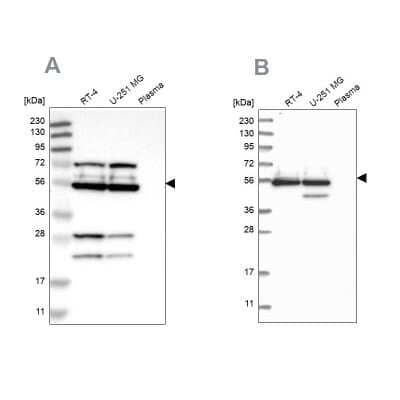 Western Blot: GRSF1 Antibody [NBP2-38341]