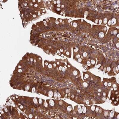 Immunohistochemistry: GRTP1 Antibody [NBP2-33458]