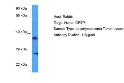 Western Blot: GRTP1 Antibody [NBP2-87529]