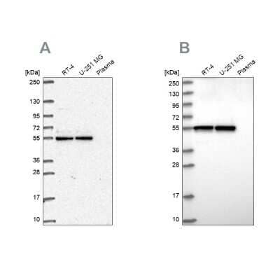 Western Blot: GRWD1 Antibody [NBP2-56888]