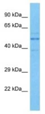 Western Blot: GRWD1 Antibody [NBP3-10088]