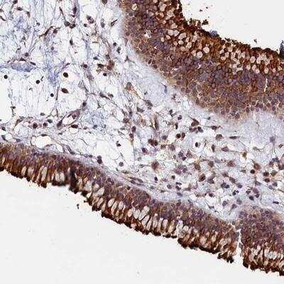 Immunohistochemistry-Paraffin: GRXCR1 Antibody [NBP1-90591]