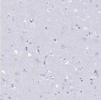 Immunohistochemistry-Paraffin: GRXCR2 Antibody [NBP2-32458]