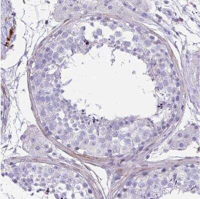 Immunohistochemistry-Paraffin: GRXCR2 Antibody [NBP2-32458]