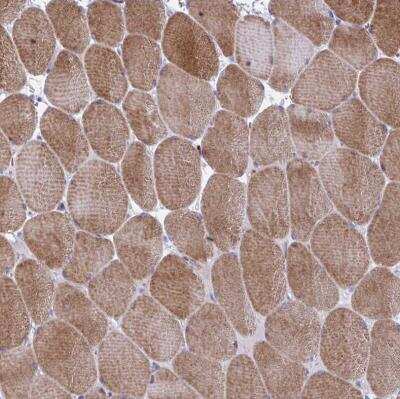 Immunohistochemistry-Paraffin: GRXCR2 Antibody [NBP2-32458]