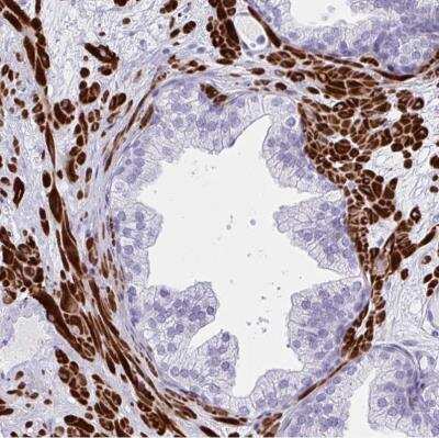 Immunohistochemistry-Paraffin: GRXCR2 Antibody [NBP2-32458]