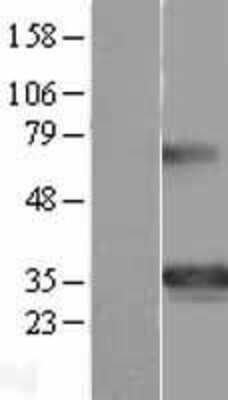 Western Blot: Goosecoid Overexpression Lysate [NBL1-11357]