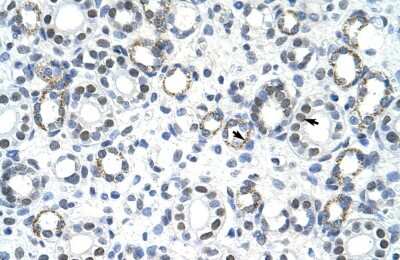 Immunohistochemistry: GSC2 Antibody [NBP2-82957]