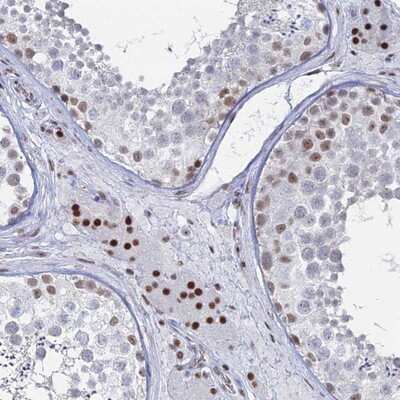 Immunohistochemistry-Paraffin: GSC2 Antibody [NBP1-91970]