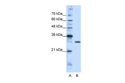 Western Blot: GSC2 Antibody [NBP2-82957]