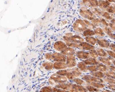 Immunohistochemistry-Paraffin: GSDMDC1 Antibody [NBP2-80427]