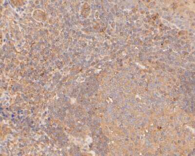 Immunohistochemistry-Paraffin: GSDMDC1 Antibody [NBP2-80427]