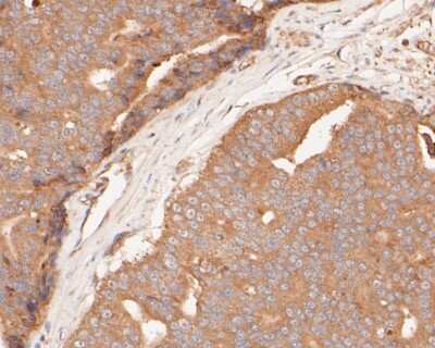 Immunohistochemistry-Paraffin: GSDMDC1 Antibody [NBP2-80427]