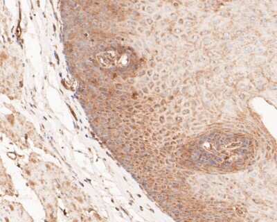 Immunohistochemistry-Paraffin: GSDMDC1 Antibody [NBP2-80427]