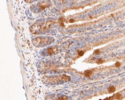 Immunohistochemistry-Paraffin: GSDMDC1 Antibody [NBP2-80427]