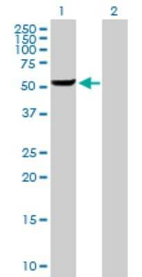 Western Blot: GSDMDC1 Antibody [H00079792-B01P]