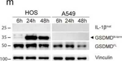 Western Blotting of GSDMDC1 in SFV4-Infected HOS and A549 Cells