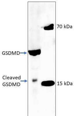 Western Blot Analysis of GSDMDC1 in Treated THP1 Cells