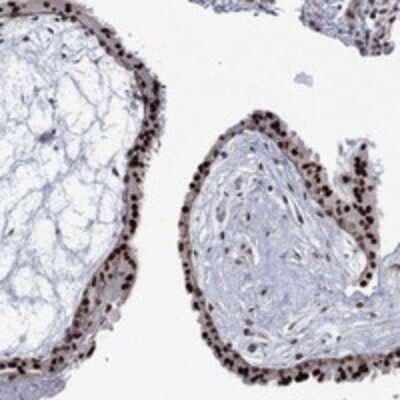 Immunohistochemistry-Paraffin: GSE1 Antibody [NBP3-17501]