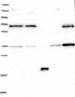 Western Blot: GSE1 Antibody [NBP3-17501]